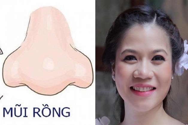 Mũi rồng