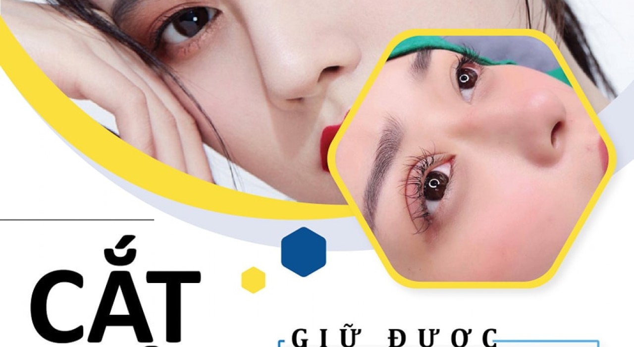Cắt mí có giữ được vĩnh viễn không?