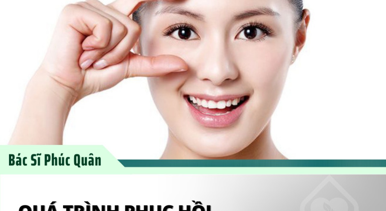 Quá trình hồi phục sau khi phẫu thuật cắt mí mắt