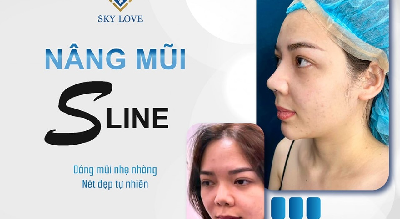 Nâng mũi S line là gì – Bác sĩ giỏi nâng mũi đẹp tại TP HCM