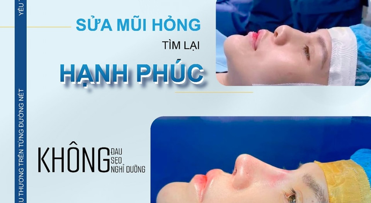 Nâng mũi cấu trúc hỏng có sửa lại được không?