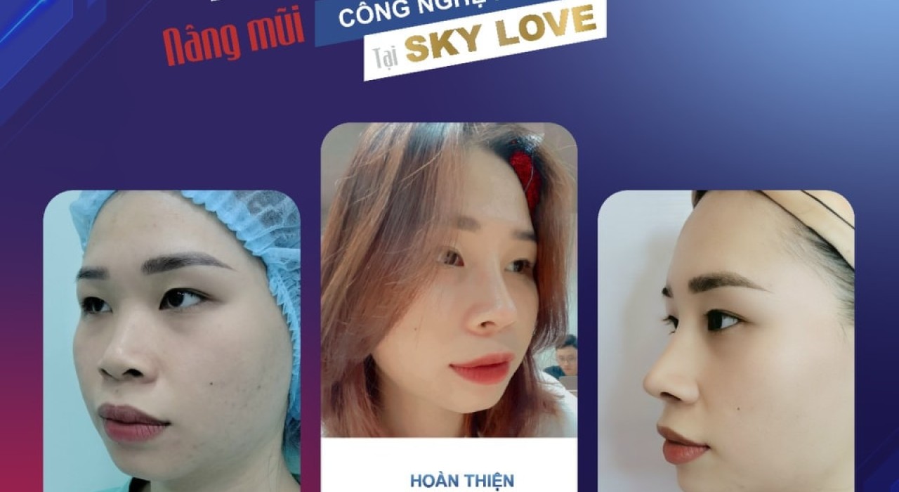 NÂNG MŨI CÓ THAY ĐỔI KHUÔN MẶT KHÔNG