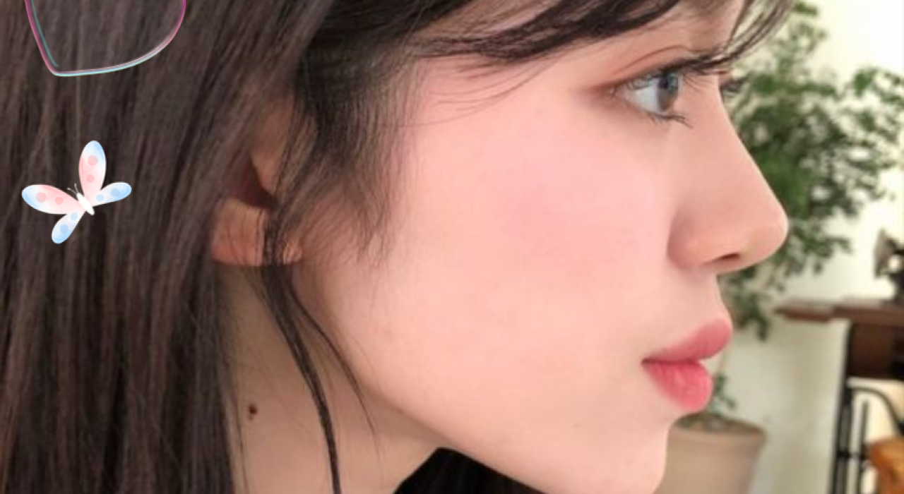 Có nên nâng mũi bằng sụn tai? Sau bao lâu thì vào form ổn định