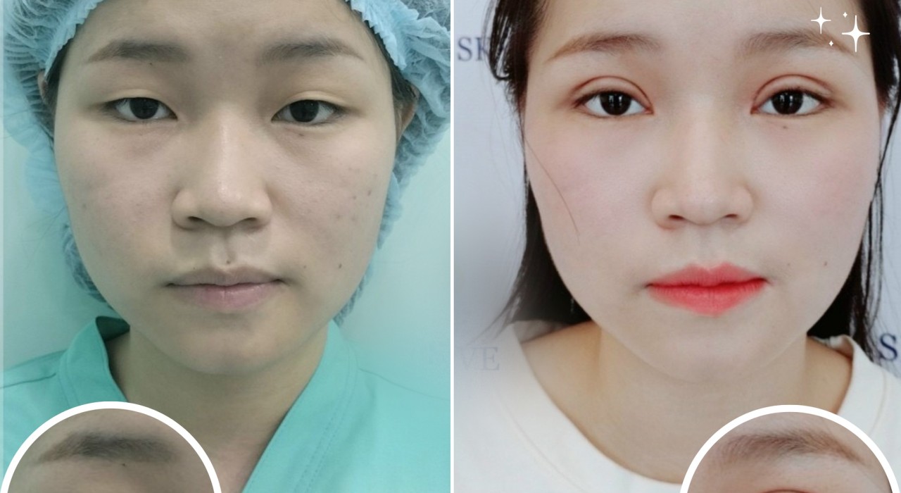 Mắt 1 mí đẹp hay xấu? – Cách khắc phục mắt 1 mí “cải vận” tướng số
