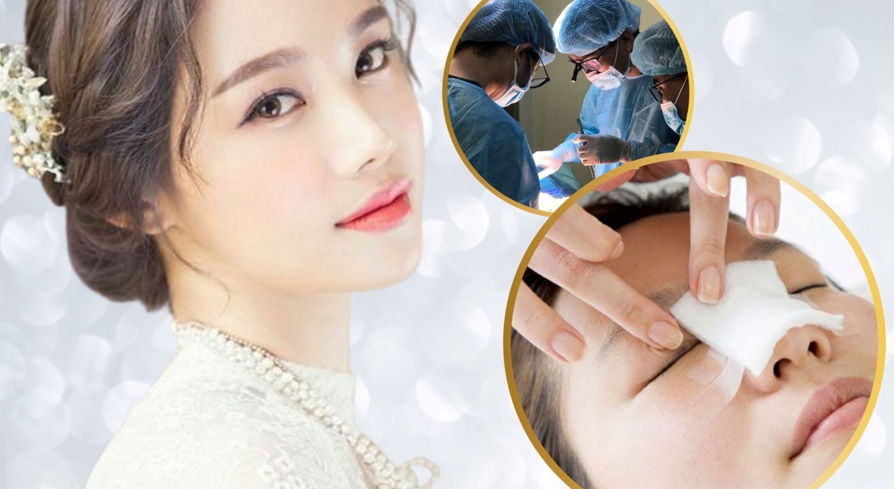 TOP 9 loại sụn nâng mũi tốt nhất hiện nay tạo dáng đẹp nhất