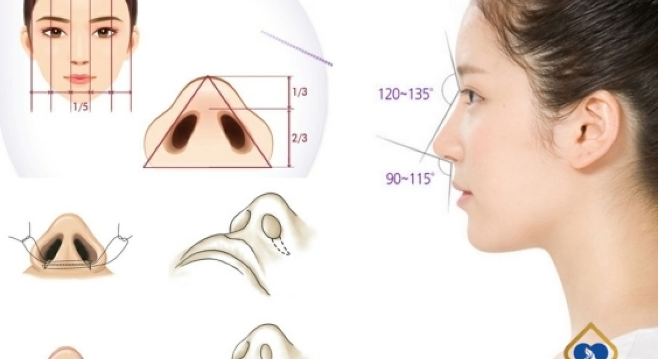 CUỘN CÁNH MŨI CÓ PHÁ TƯỚNG KHÔNG? GIẢI ĐÁP CỦA BÁC SĨ PHÚC QUÂN