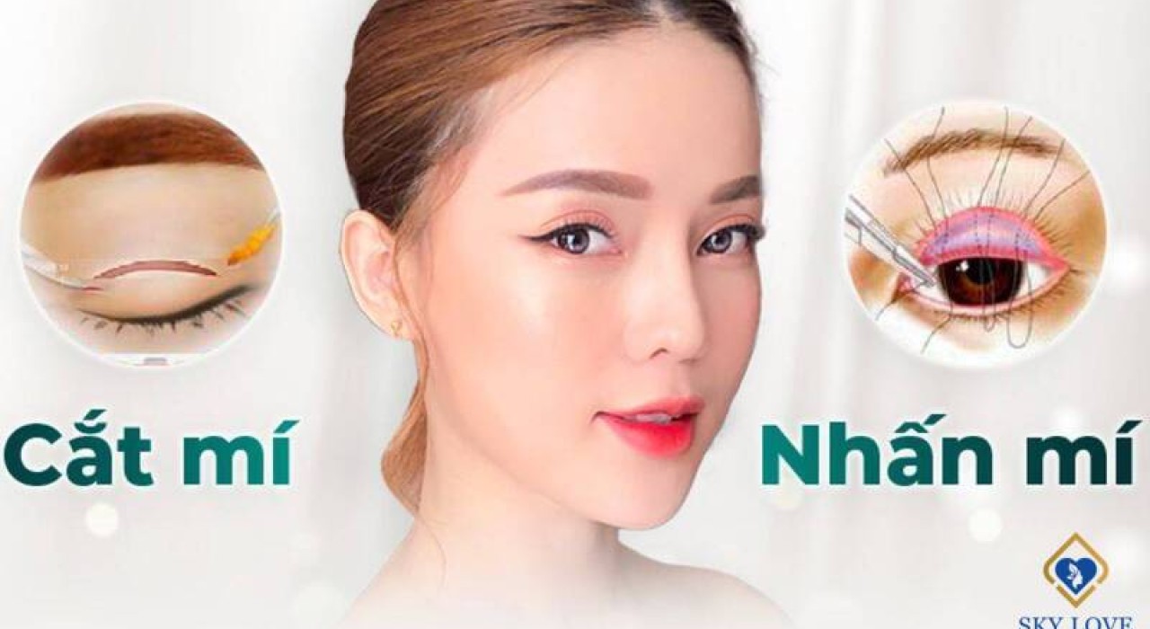 Mắt một mí nên cắt mí hay nhấn mí?