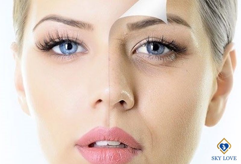 Mắt thâm quầng – Nguyên nhân và cách khắc phục hiệu quả