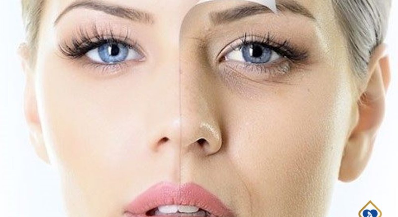 Mắt thâm quầng – Nguyên nhân và cách khắc phục hiệu quả