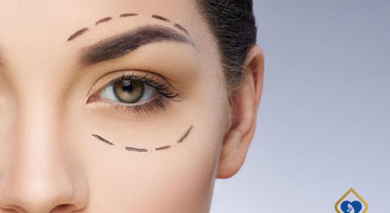 Cắt Mí Mắt Giữ Được Bao Nhiêu Năm? Cách Bảo Vệ Nếp Mí Lâu Dài