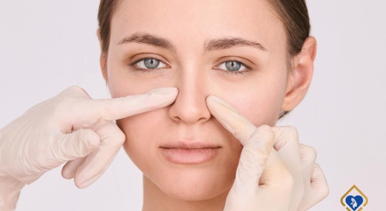 Đầu Mũi Đỏ Sau Nâng Là Biến Chứng Gì Và Hướng Giải Quyết