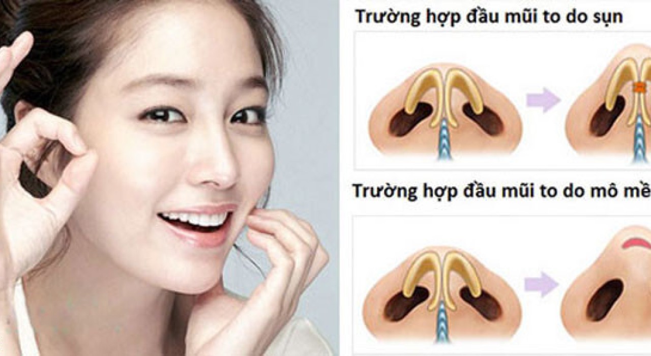 Đầu mũi tròn có nên sửa không? Tướng số tốt hay xấu