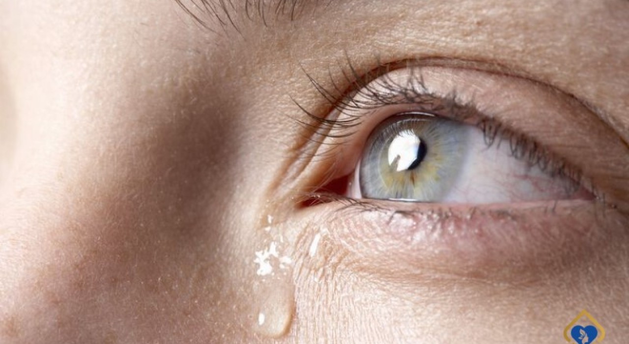 Cắt mí xong bị chảy nước mắt: Cách khắc phục triệt để