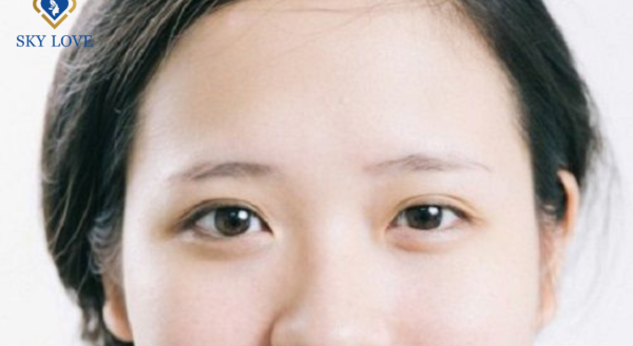 Mắt to mắt nhỏ? sướng hay khổ? Cách khắc phục nhanh