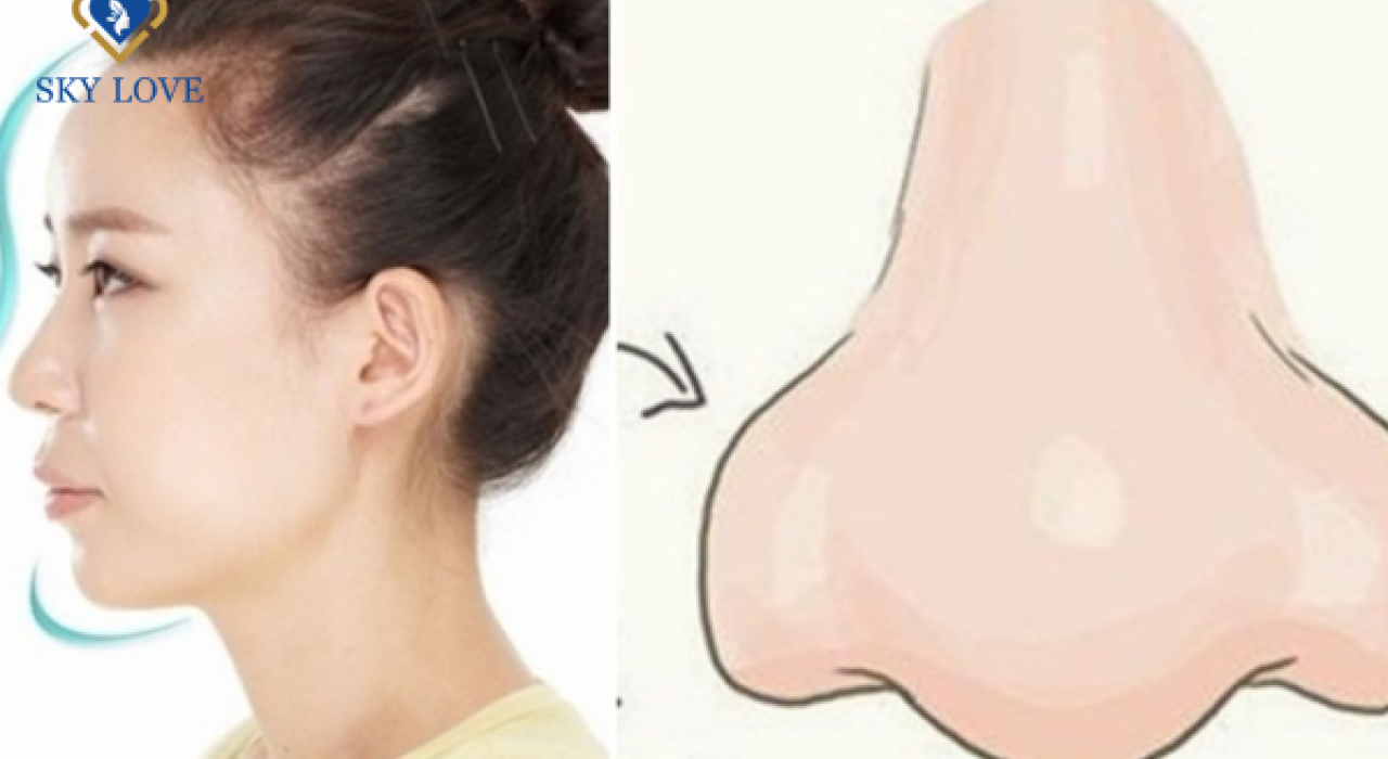 Mũi Củ Tỏi: Luận bàn Vận Hạn, Ý nghĩa cuộc đời theo Phong Thủy