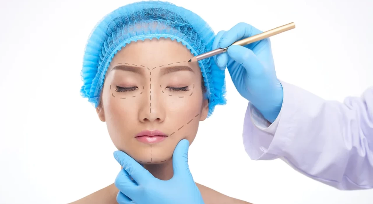 PHẪU THUẬT LẤY BỎ CHẤT LIỆU GHÉP NHÂN TẠO VÙNG ĐẦU MẶT