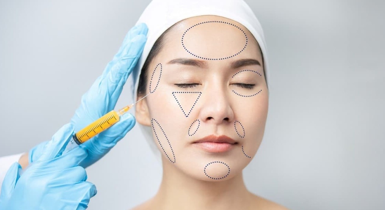 PHẪU THUẬT CẤY MỠ LÀM ĐẦY VÙNG MẶT