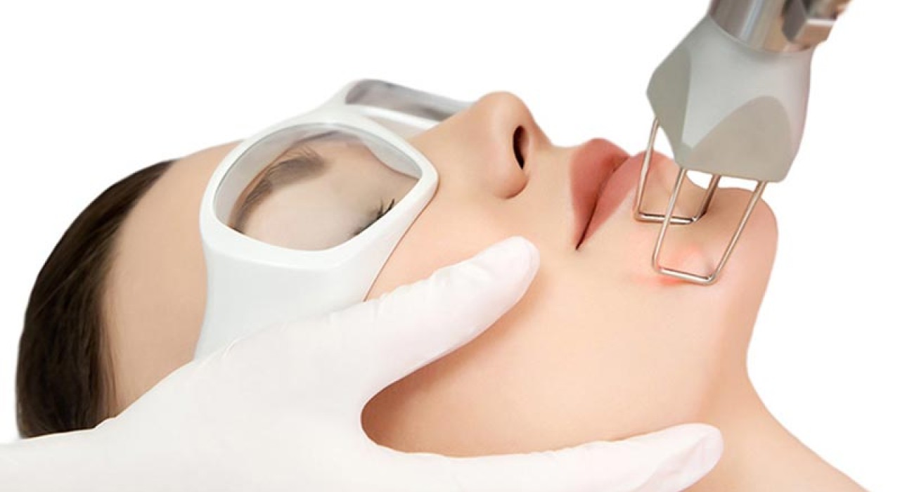 LASER ĐIỀU TRỊ U DA